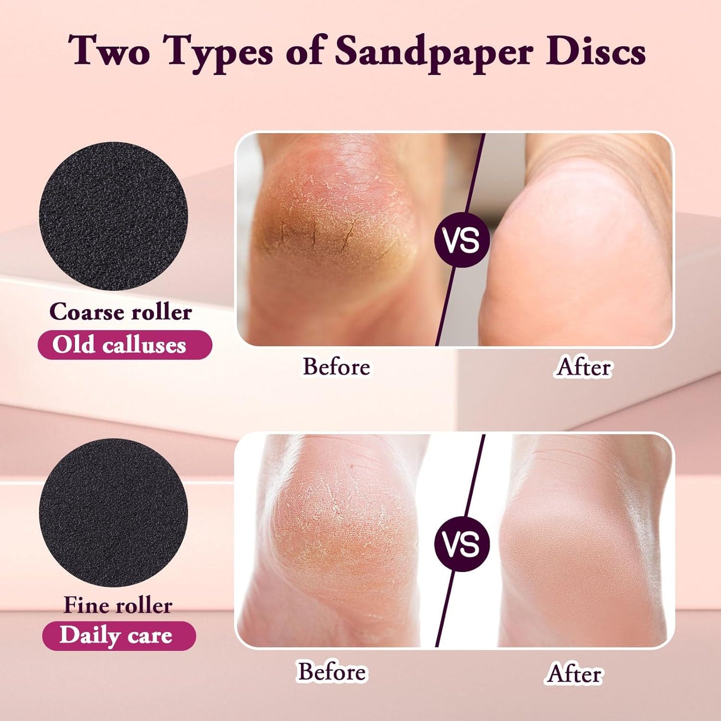 Premium Foot Care Callus RemoverTM